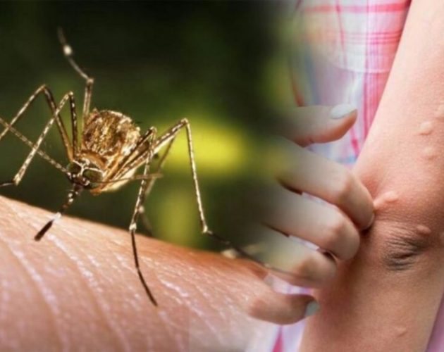 जापनिज इन्सेफ्लाइटिस सङ्क्रमणबाट यस वर्ष देशभर ३१ जनाको मृत्यु