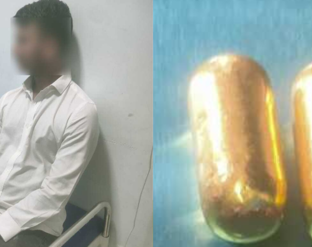 दुबईबाट आएका बंगलादेशी नागरिकको पेटमा भेटियो सुन, पाँच दिनपछि निकालियो